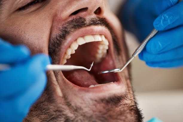 Best Urgent Tooth Repair  in Kayak Point, WA